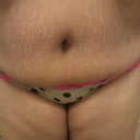 Land of many stretch marks!