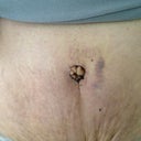 Belly button