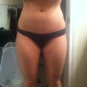 Before Picture