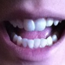 Before, with my mouth open so you can see the bottom teeth.