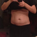 2.5 weeks. Swelling of the fat is still present.
