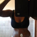 Front view 14 days Post Op.