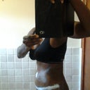 Side view 14 days Post Op.