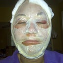 day after procedures