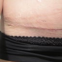 right hip
the flaky stuff is tape residue