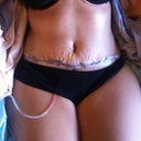 doctor said its still swollen but Im just happy with the results so far!!