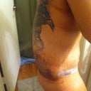 side view swollen and bruised