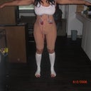 1 day post op very swollen ladies