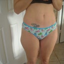 Before.  This was the day of the surgery.