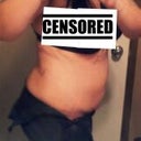 8 days after.. Swollen in the abdomen, but better then before!