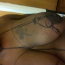 Before  Op