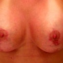 6 weeks wish my boob would heal