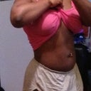 2 months post op