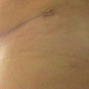 My left side still need to flatten abit