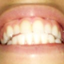 5 Days after