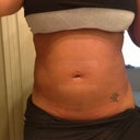 3 days post