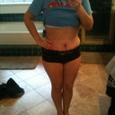 3 WEEKS POST OP!! STILL SWOLLEN..... :(