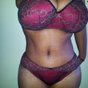 1 month post op