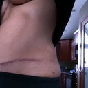 5 months PO  : (