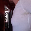 Before- Side View