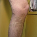before surgery