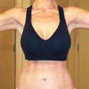 3.5 months post op.