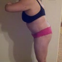 10 days post op