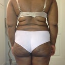 Before Pic