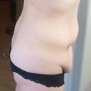 Right side