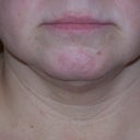 3 weeks after