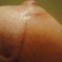 My dent - appears as a dark spot, but is actually a dent.  Hopefully it goes away.