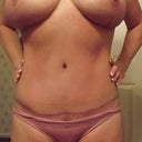 closer look at tummy scar 9wks