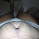 Swollen
