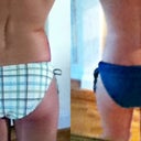 5 1/2 weeks Post-Op: Swimsuit comparison
