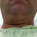 Before Surgery