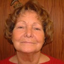 72 Year Old Woman Has Phenol Peel