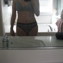 after revision my underwear still covers scar