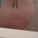 3 weeks post op