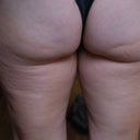 super ugly close up of my bum (thank goodness this is anonymous!)