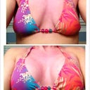 Day 4 Before/After