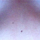 my incisions!