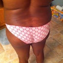 pre-op back & but view