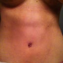 my 4-pack :) 6 weeks post op. photoshopped vertical