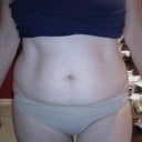 BEFORE Front view of belly.  You can't really see the damaged, pulled skin.  It's really low near my c-section scar.