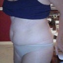 BEFORE Side view of belly