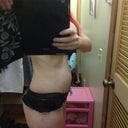 1 Month and 4 days post op