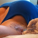 Treatment #1... ouch!