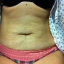 This is my before picture.  Notice the lack of a belly button!! :(