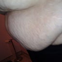 ok last pic. I dont understand why the dip in the stomach either becasue it is all extra skin its like something from a science fiction movie