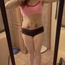 PO day 15 bruises still pretty gnarly but getting better. (the marks at my rib cage are from my foam pad)